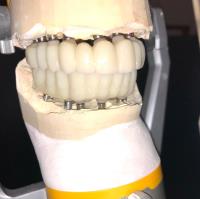 Meng Dentistry image 7